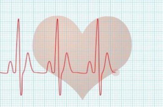 Fibrillation atriale : le diagnostic précoce sauve des vies