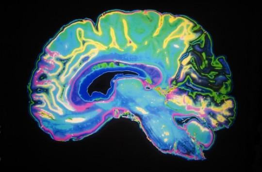 Tremblement essentiel : efficacité des ultra-sons IRM-focalisés