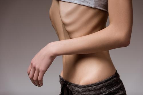 Anorexie, boulimie : des effets négatifs à long terme 