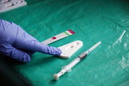 VIH : la Grande Bretagne teste un nouveau traitement éradicateur