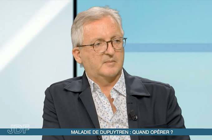 Maladie de Dupuytren : quand opérer ?