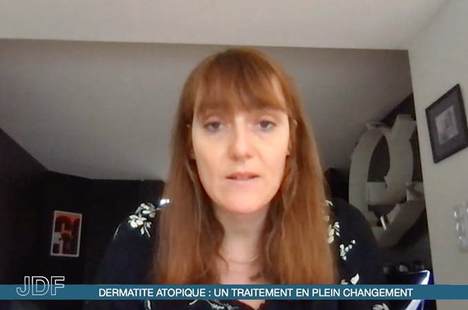 Dermatite atopique : un traitement en plein changement