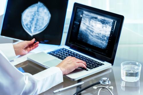 Mammographie : une nouvelle étude du NEJM relance la polémique