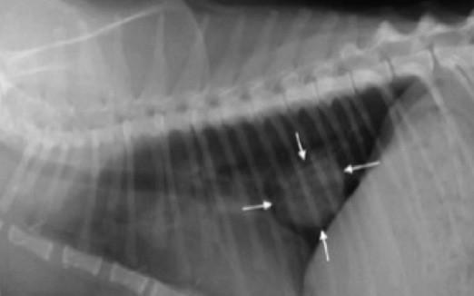 Cancer du poumon : le test sanguin, une avancée majeure ?