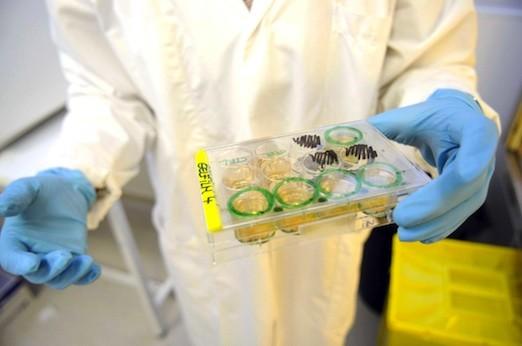 Première mondiale française en thérapie cellulaire cardiaque