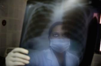 Tuberculose multi-résistante : des solutions pour les malades incurables 