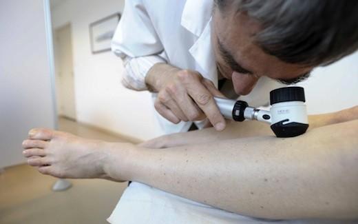 Un vaccin thérapeutique prometteur contre le mélanome