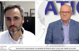 Douleur et gonflement du membre inférieur  ...